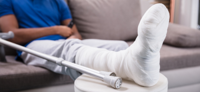 employee with broken leg Quotacy blog Key Person Disability Insurance